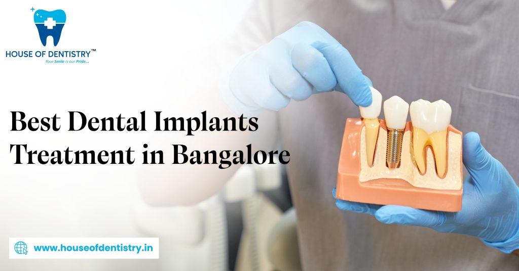 Best Dental Implants Treatment in Bangalore