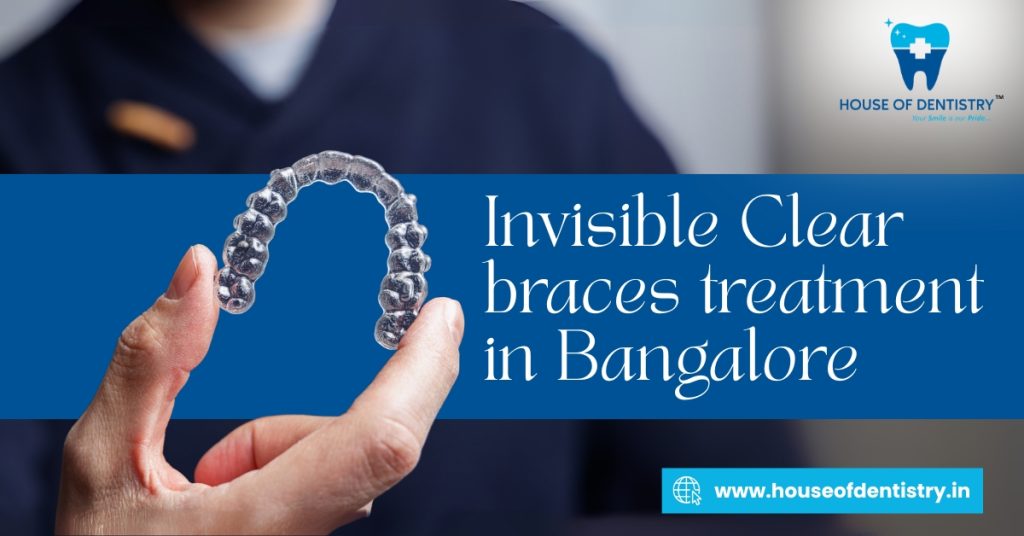 Invisible Clear braces treatment in Bangalore- House of Dentistry