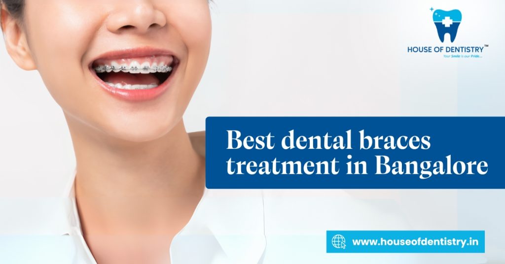 Best Dental Braces Treatment in Bangalore House of Dentistry