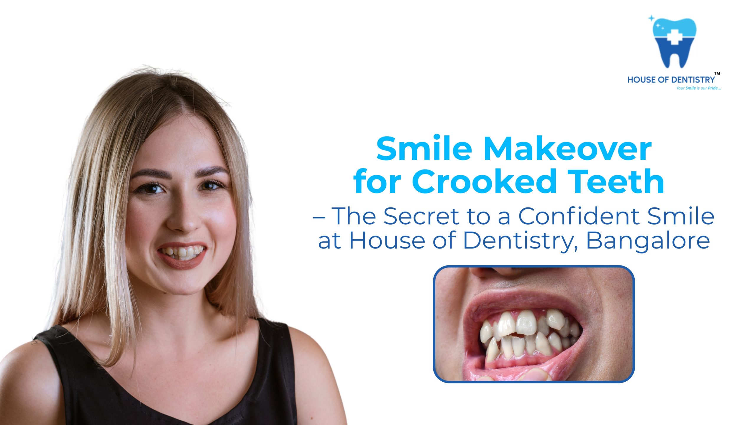 Smile Makeover for Crooked Teeth – The Secret to a Confident Smile at House of Dentistry, Bangalore