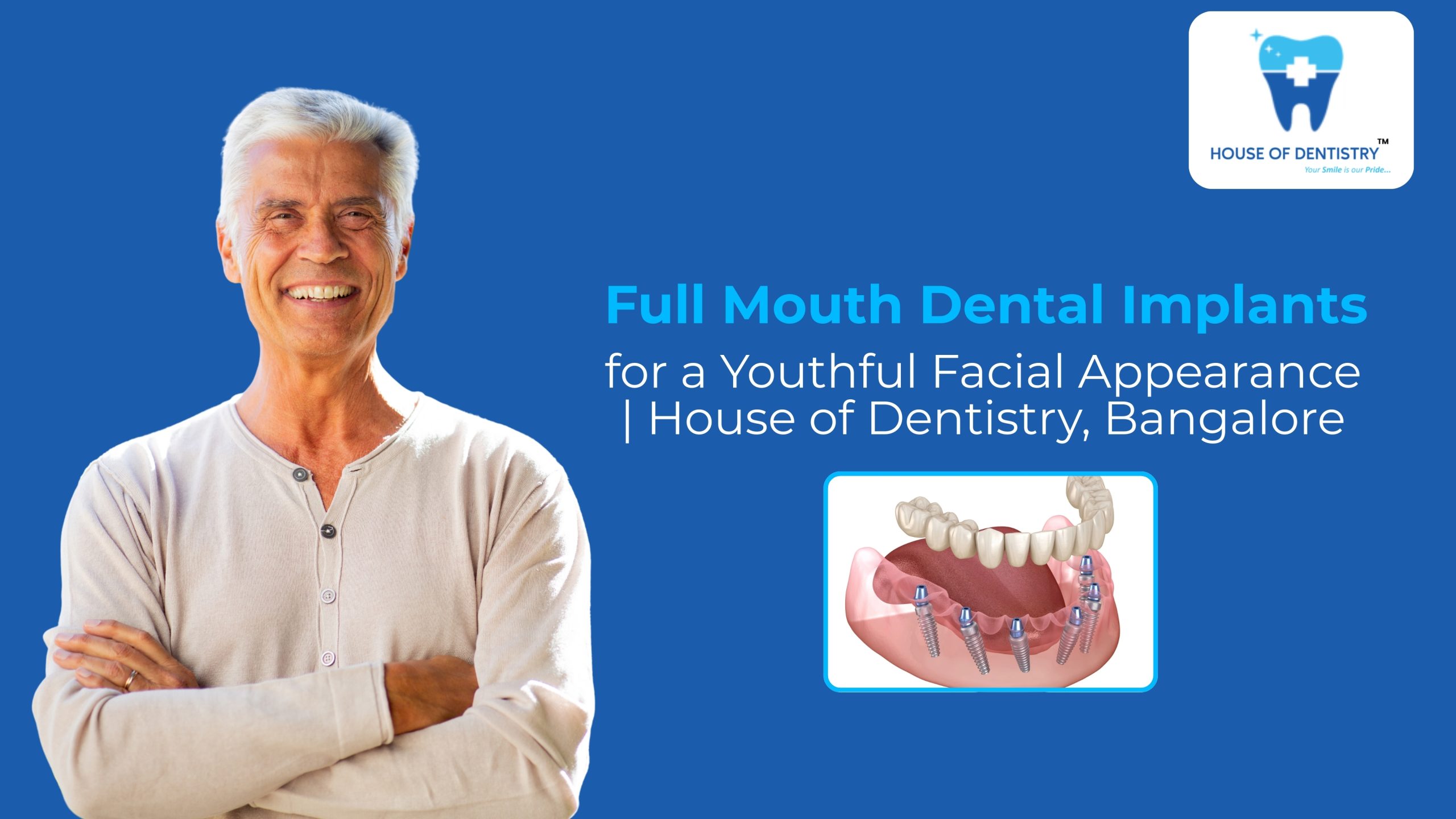 Full Mouth Dental Implants for a Youthful Facial Appearance | House of Dentistry, Bangalore