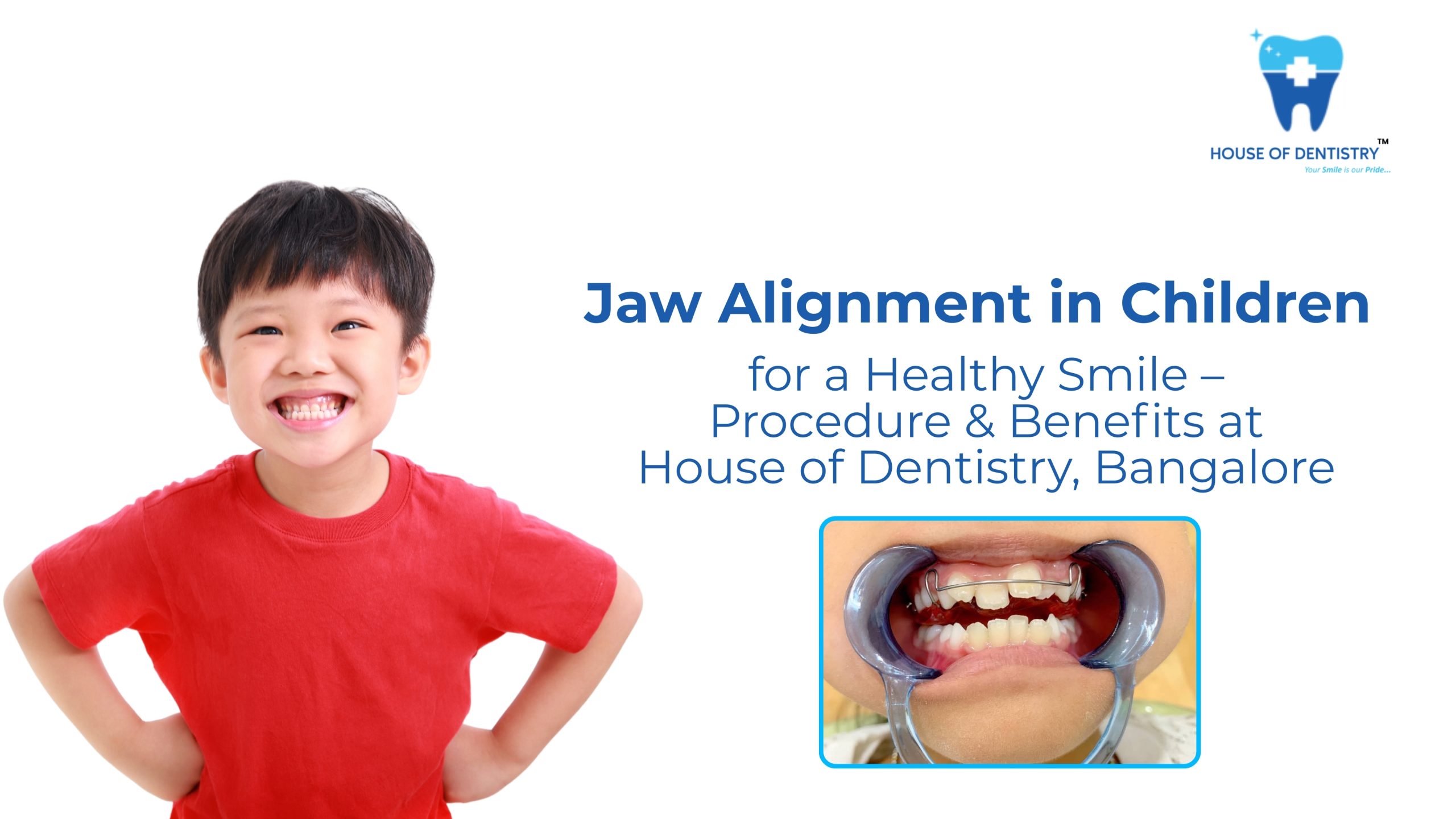 Jaw Alignment in Children for a Healthy Smile – Procedure & Benefits at House of Dentistry, Bangalore