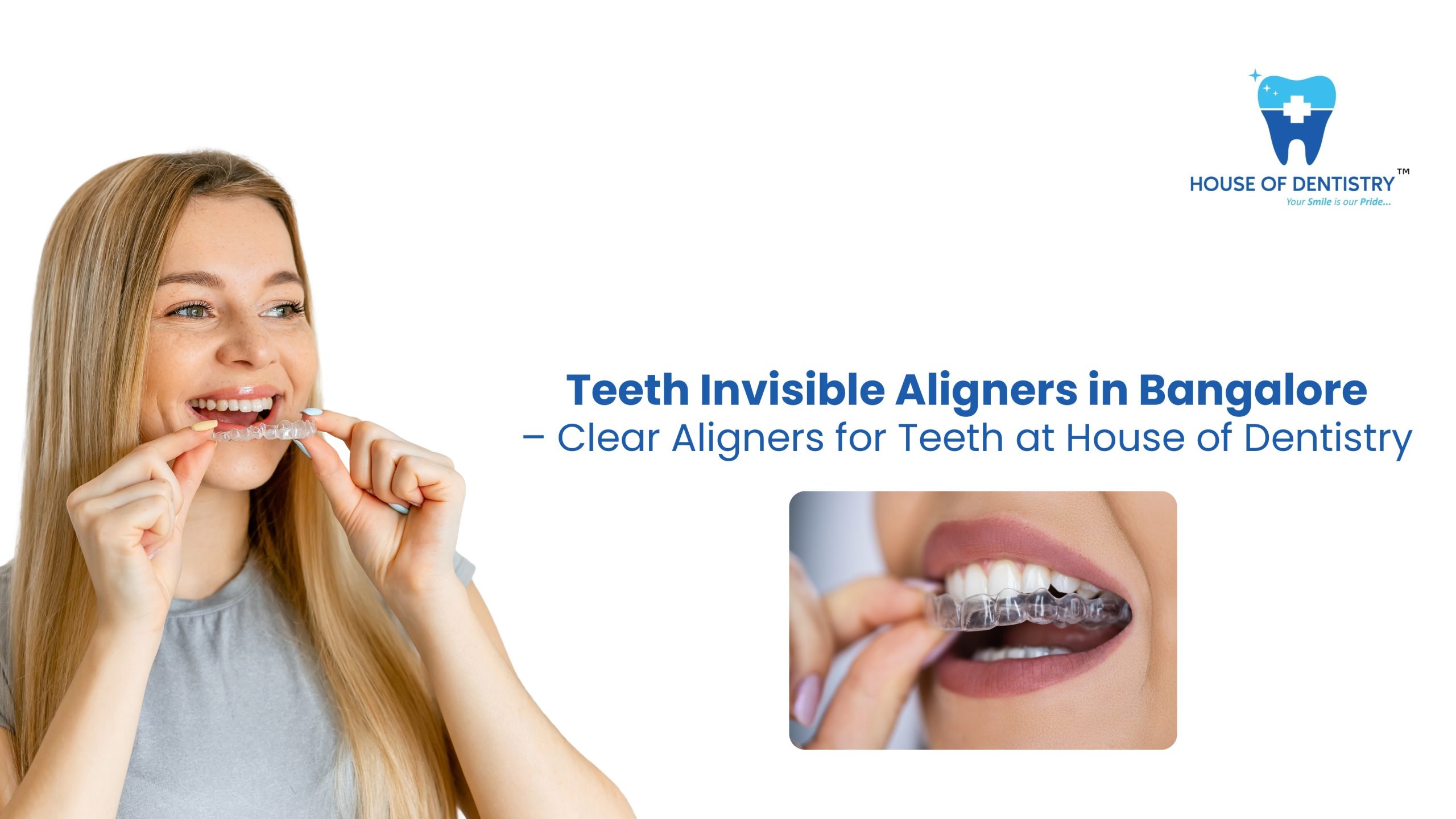 Teeth Invisible Aligners in Bangalore – Clear Aligners for Teeth at House of Dentistry