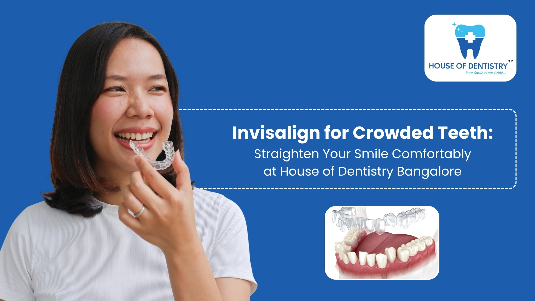 Invisalign for Crowded Teeth: Straighten Your Smile Comfortably at House of Dentistry Bangalore