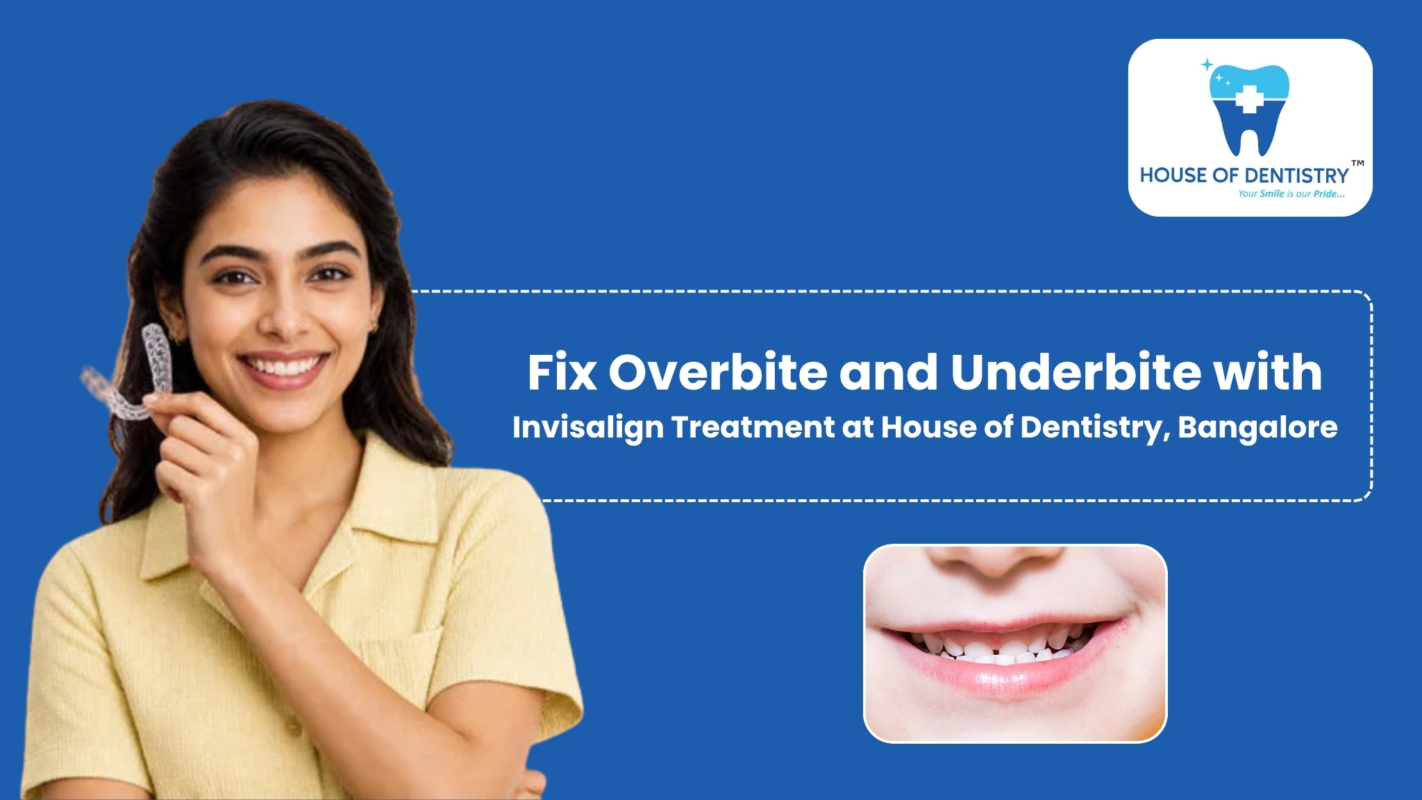 Fix Overbite and Underbite with Invisalign Treatment at House of Dentistry, Bangalore