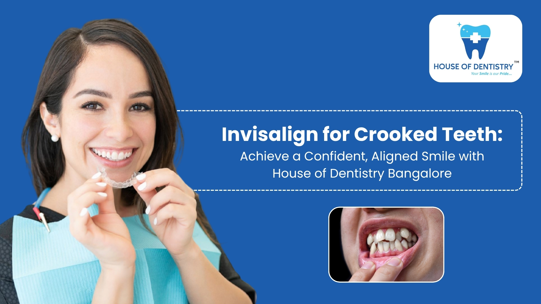 Invisalign for Crooked Teeth: Achieve a Confident, Aligned Smile with House of Dentistry Bangalore