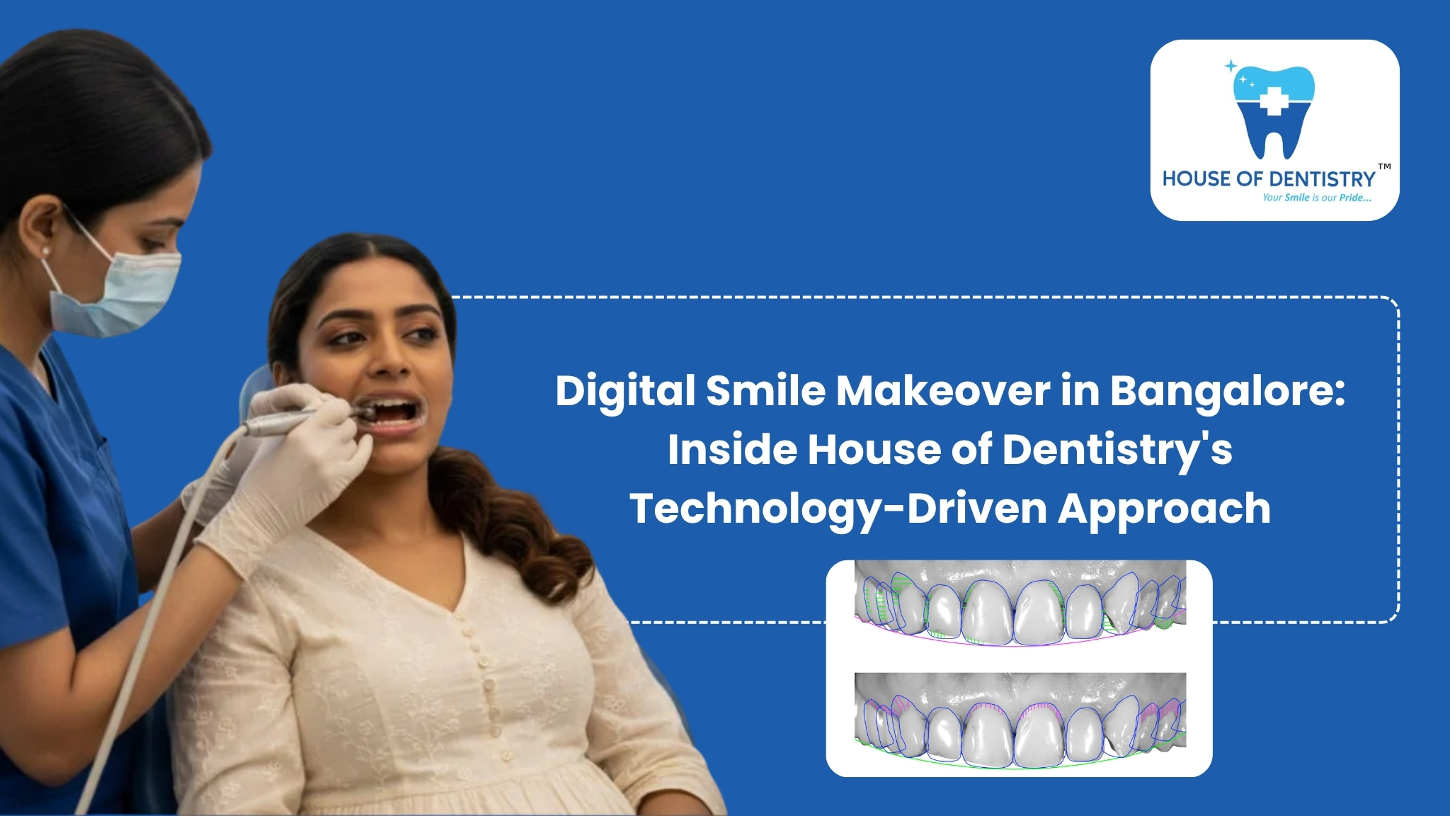 Digital Smile Makeover in Bangalore: Inside House of Dentistry’s Technology-Driven Approach