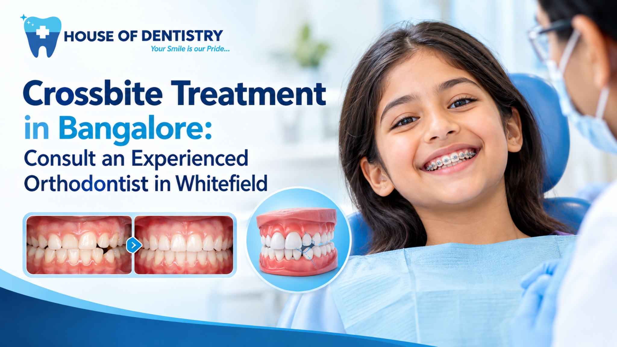 Crossbite Treatment in Bangalore: Consult an Experienced Orthodontist in Whitefield